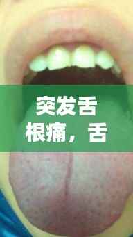突发舌根痛，舌根突然很疼 