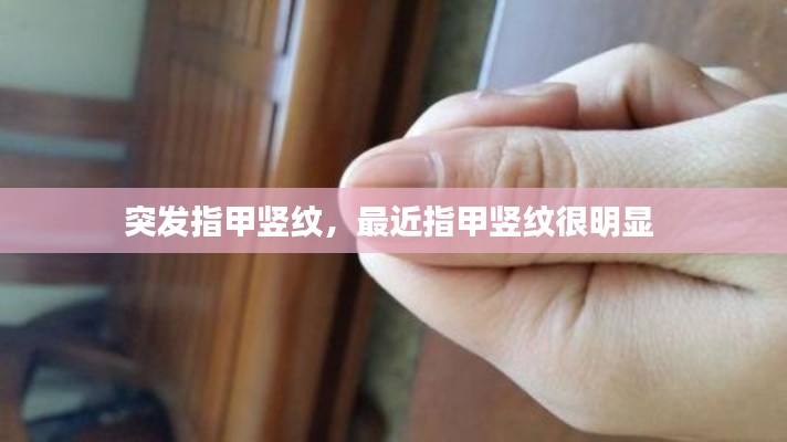 突发指甲竖纹,最近指甲竖纹很明显